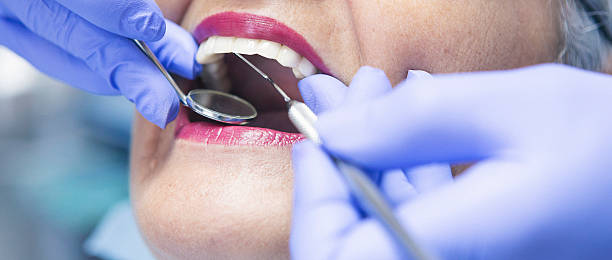 Best Emergency Dentist for Lost Fillings or Crowns in Goodwell, OK