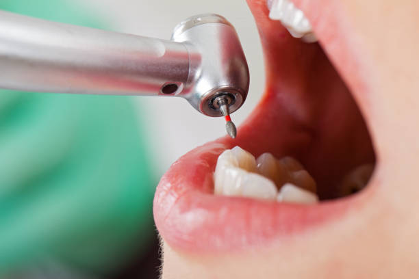 Best Weekend Emergency Dentist in Goodwell, OK
